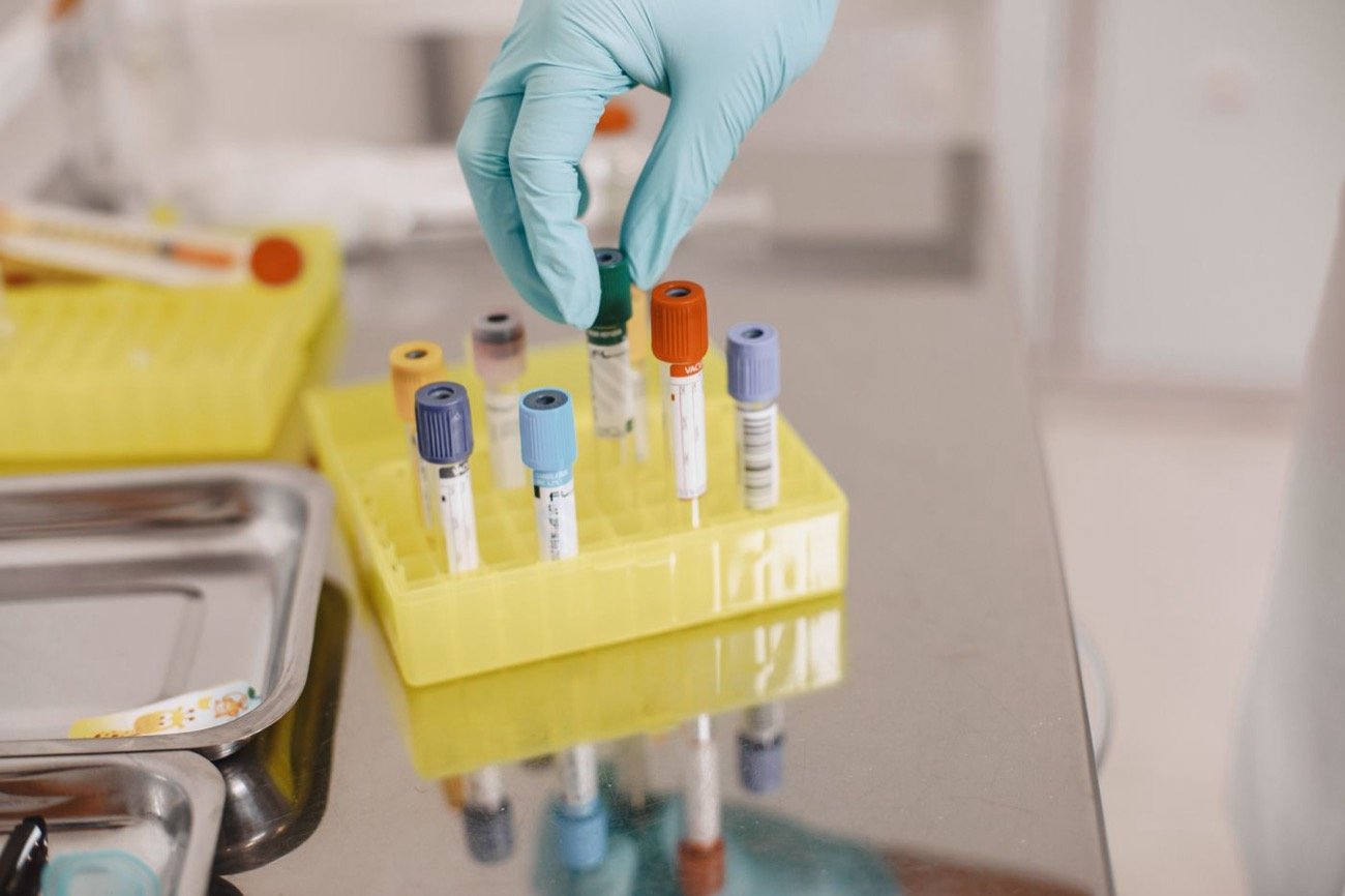 Healthcare provider preparing a blood test tube