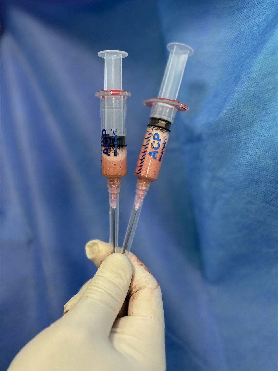 Hand holding syringes with a clear substance